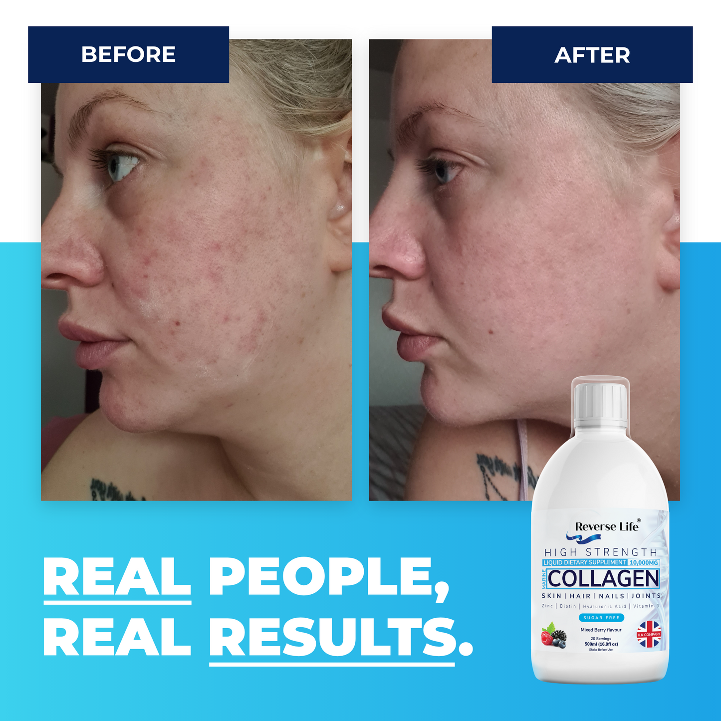 Marine Collagen