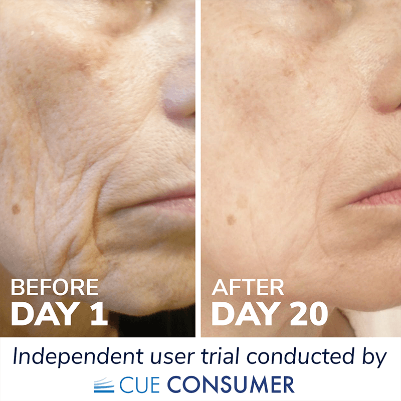 Collagen for skin results