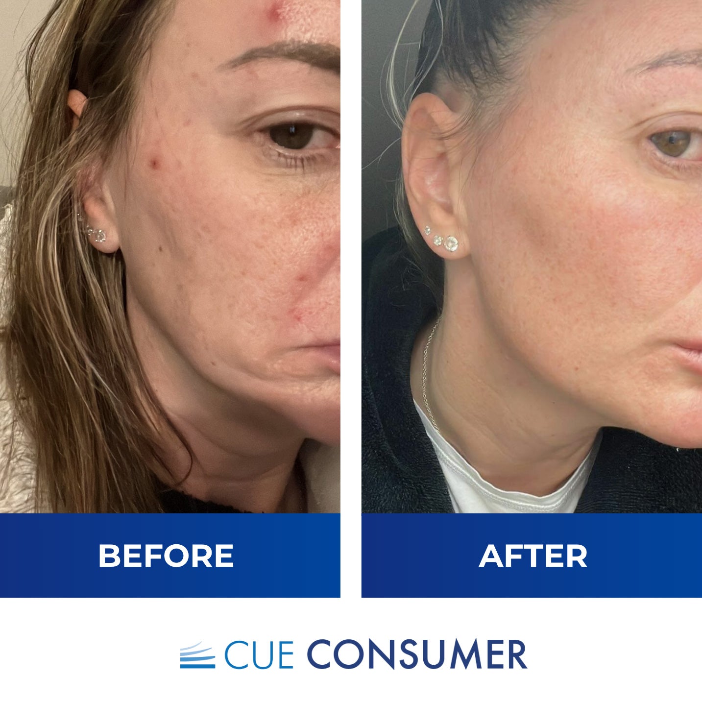 Marine Collagen