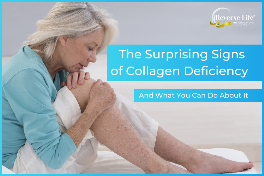 The Surprising Signs of Collagen Deficiency and What You Can Do About It