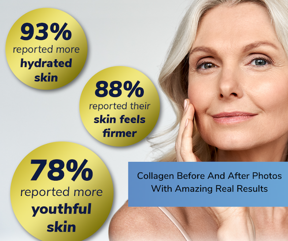 Collagen Before And After Photos With Amazing Real Results