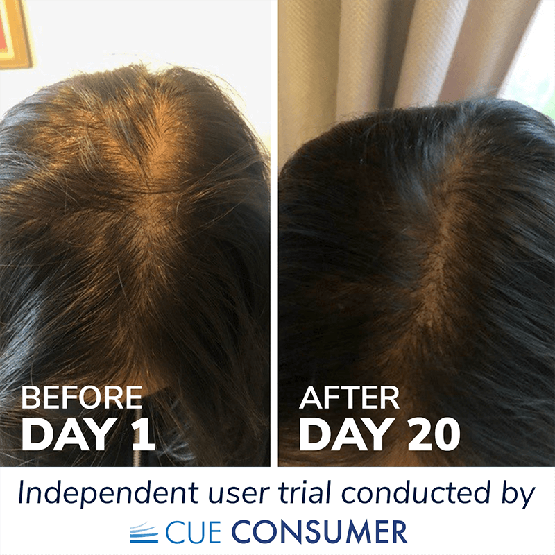 Collagen for hair results