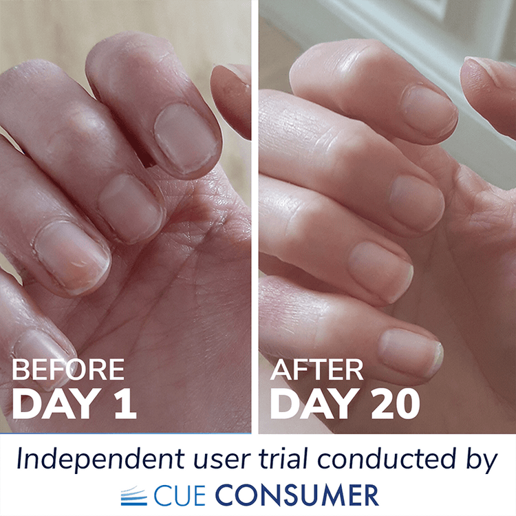 Collagen for nails results
