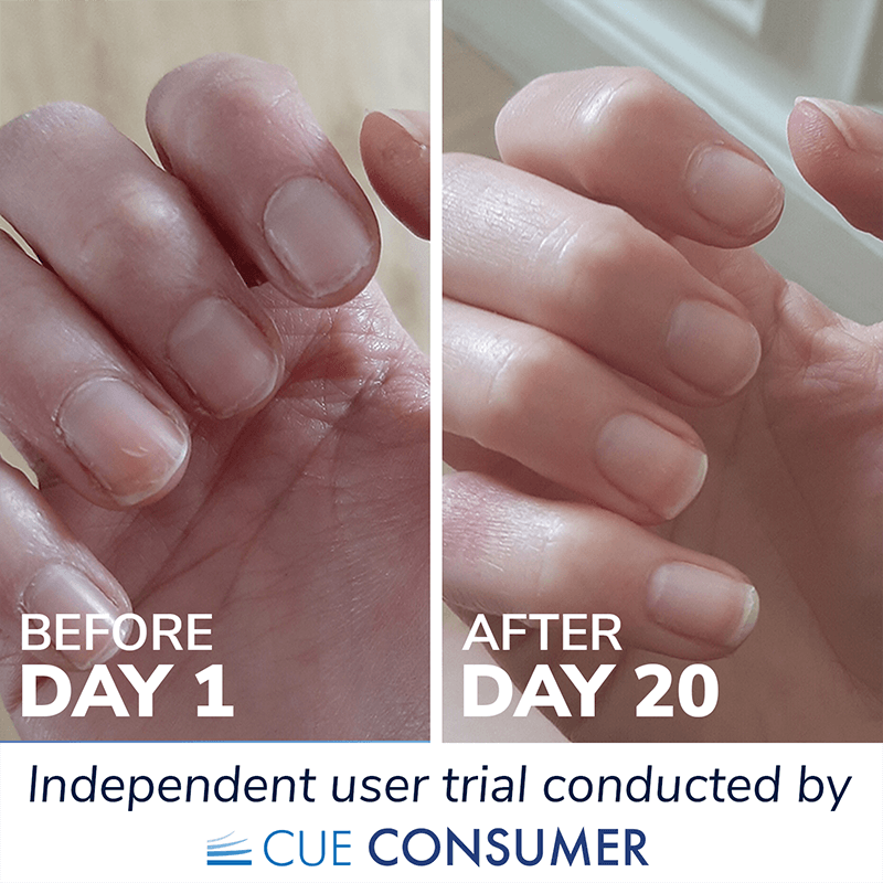 Collagen for nails results