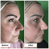 Wrinkle Lift Filler Day Cream