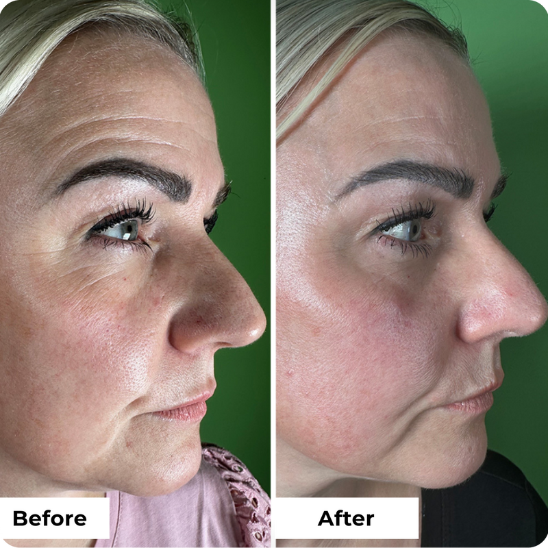 Wrinkle Lift Filler Eye Cream