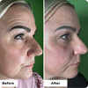 3-Piece Wrinkle Lift Collection