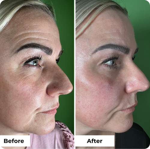 3-Piece Wrinkle Lift Collection
