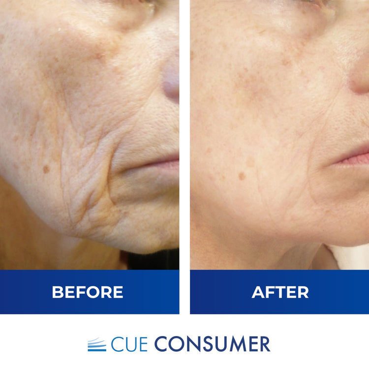 5 Bottles Marine Collagen