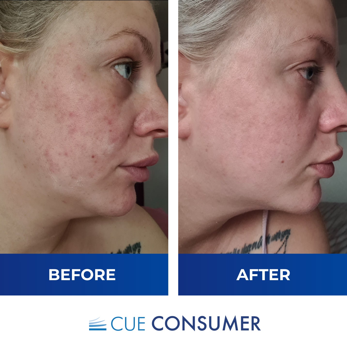 3 Bottles Liquid Collagen Ongoing Subscription Buy Now