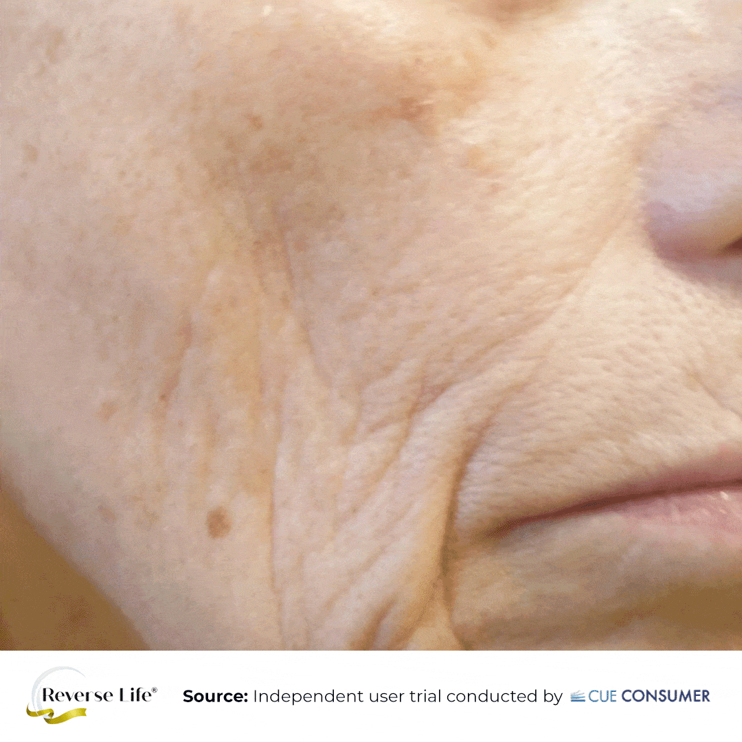 Skin before and after using Reverse Life collagen
